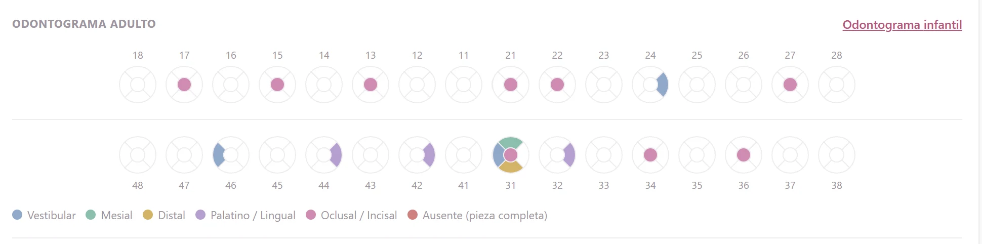 Odontograma digital adulto de Lumière con registro por pieza y por cara
